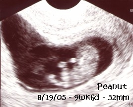 peanut-8-19.jpg