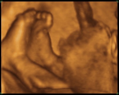 Preivew-ultrasound-pic-cropped-3.jpg