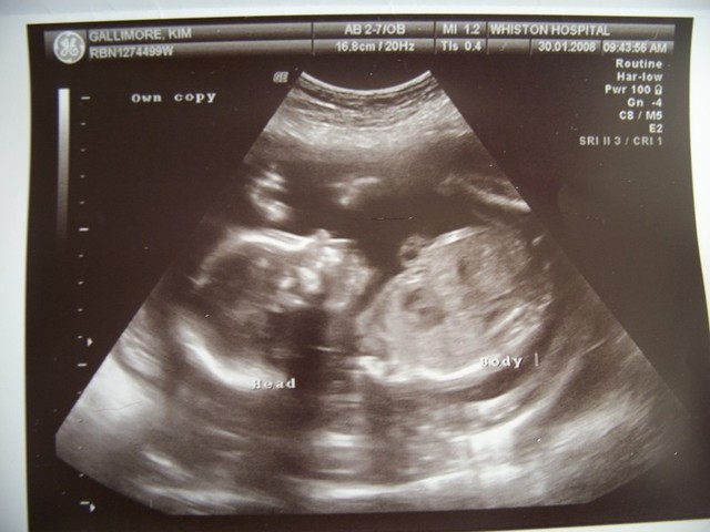 baby32ndscan0051.jpg
